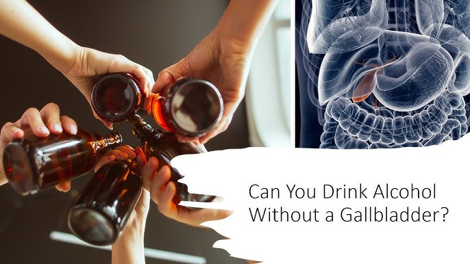 Is It Safe to Drink Alcohol Without a Gallbladder？ Health Insights