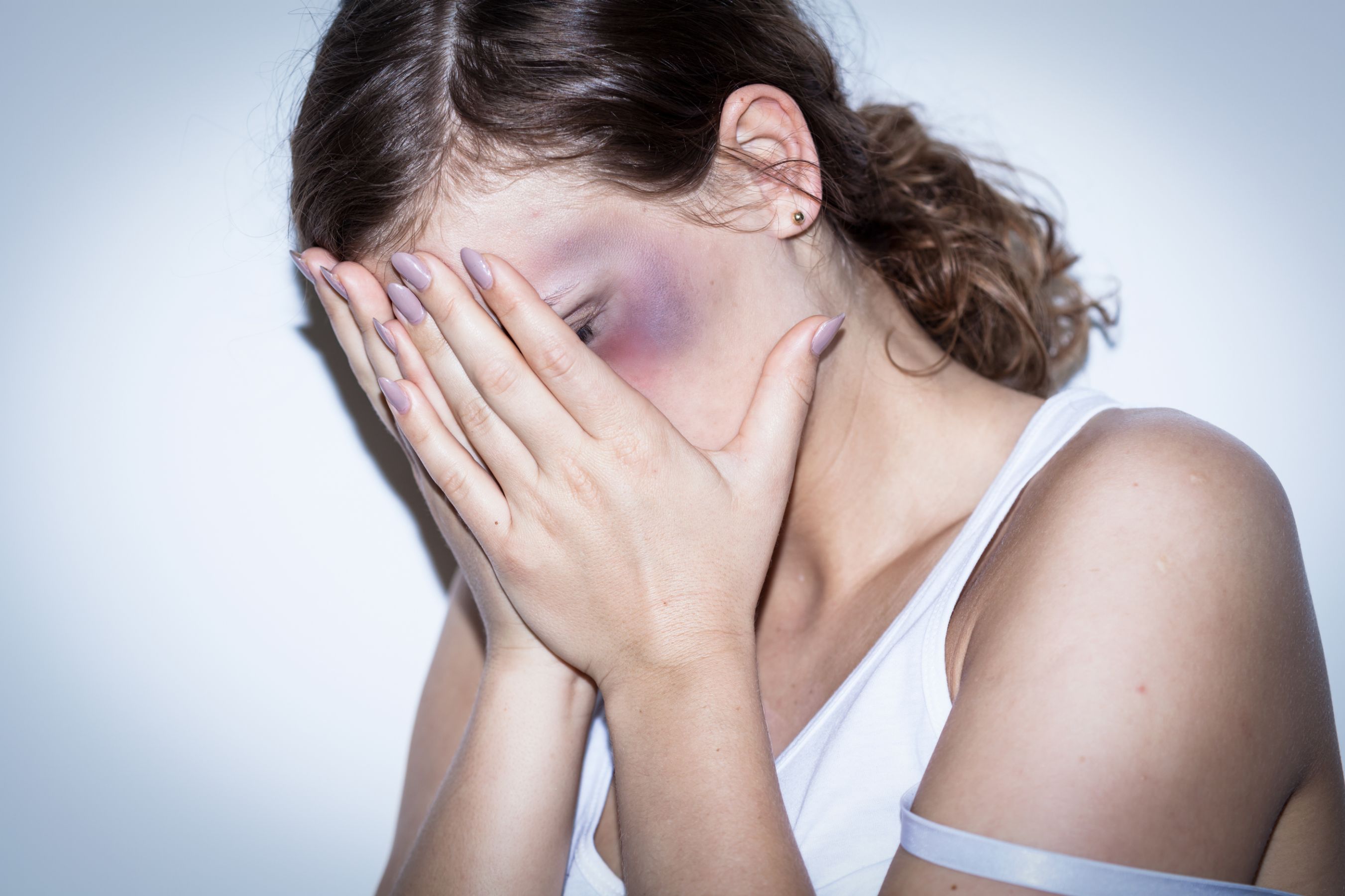 My Wife Is Hitting Me： Recognizing Signs of Abuse and Steps to Take