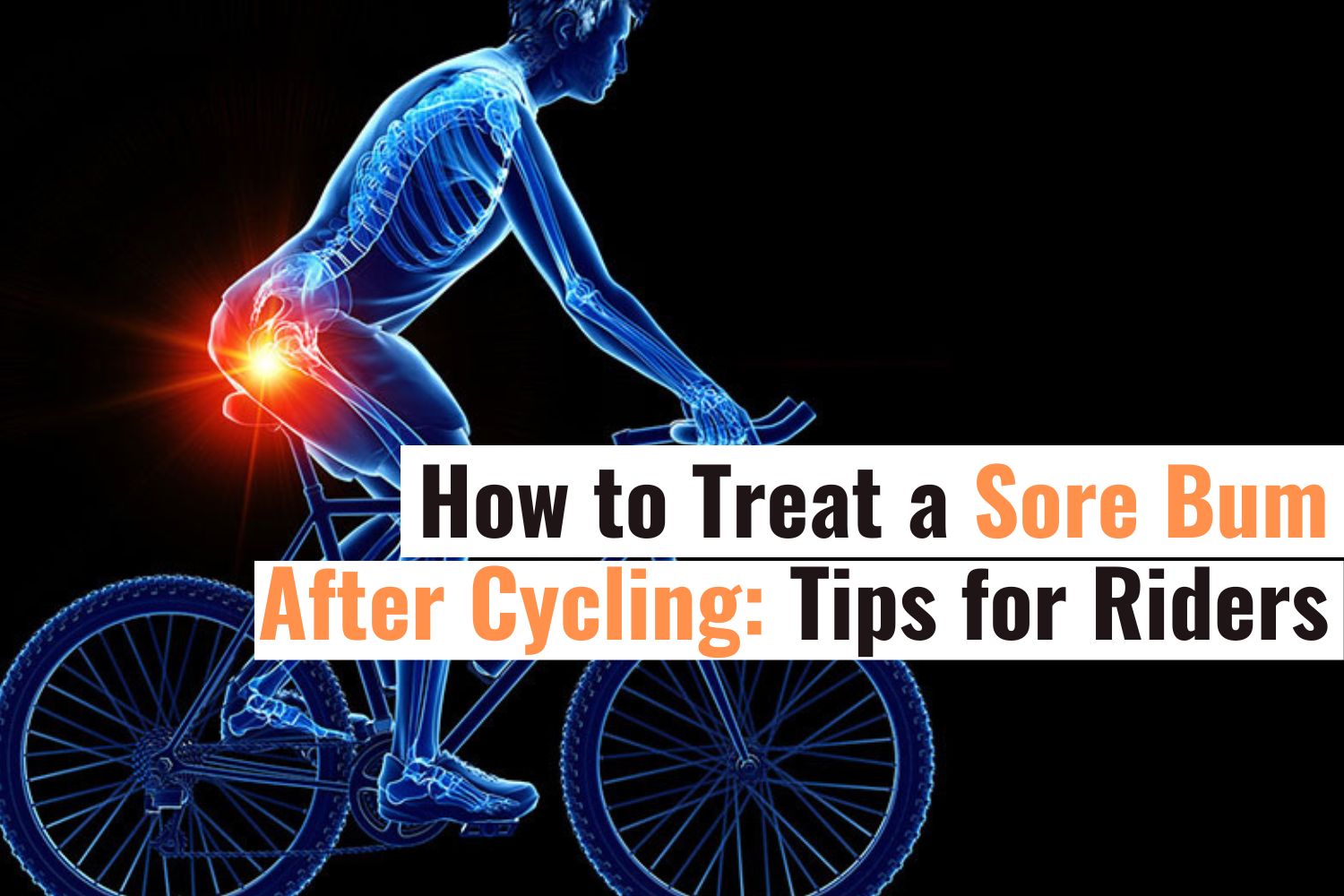 What Causes Buttock Pain After Cycling and How to Relieve It