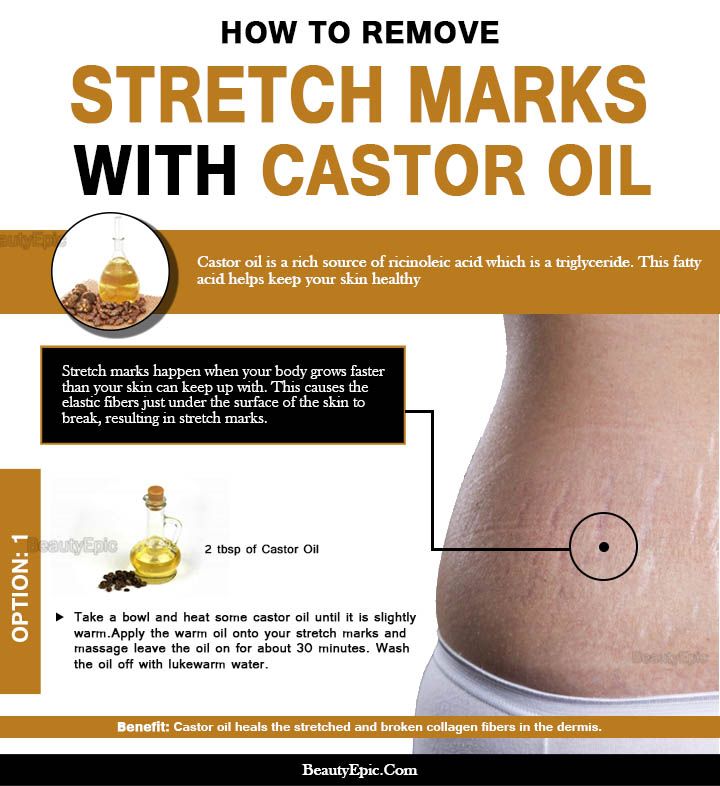 Can Castor Oil Reduce Stretch Marks? Benefits and How to Apply