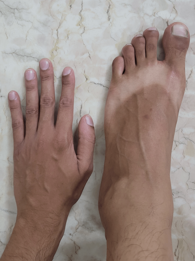 Best Methods for Fading Tan on Feet: Tips and Tricks