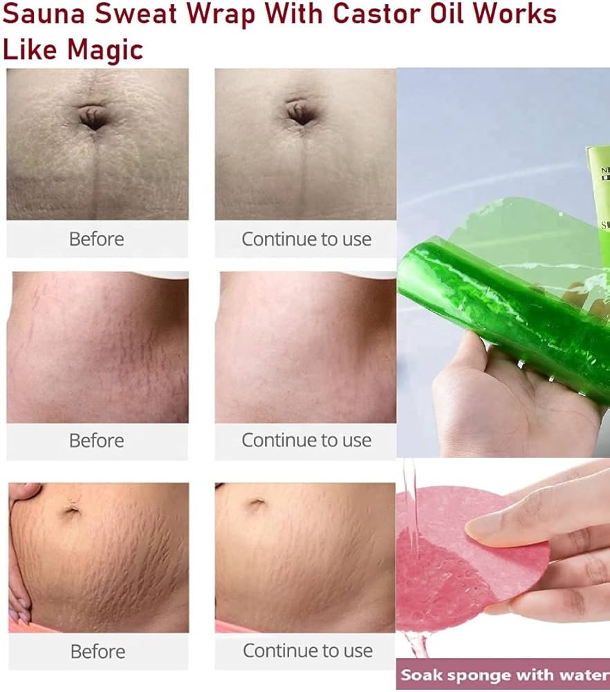 Can Castor Oil Reduce Stretch Marks? Benefits and How to Apply