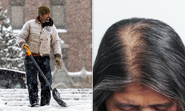 Winter Hair Loss: Tips to Combat Shedding in Cold Weather