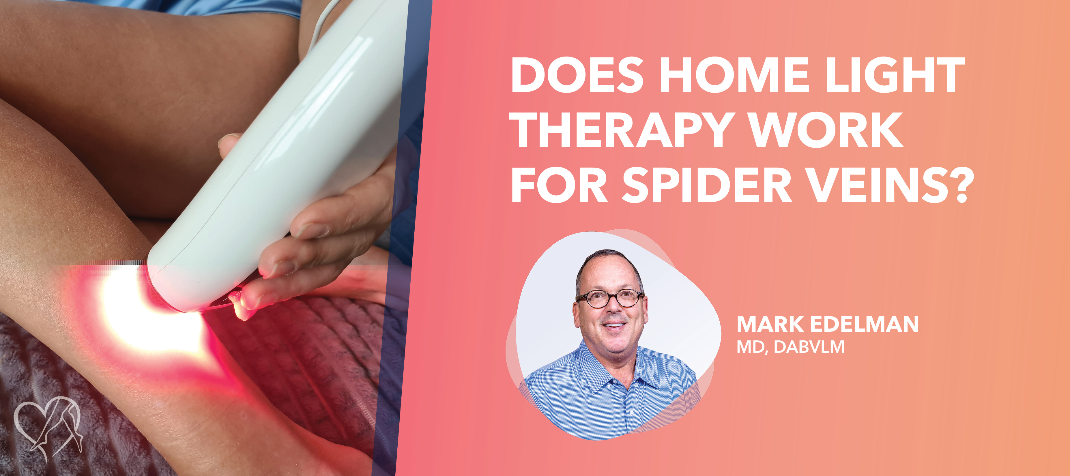 Is Laser Treatment for Spider Veins at Home Worth It? Pros and Cons