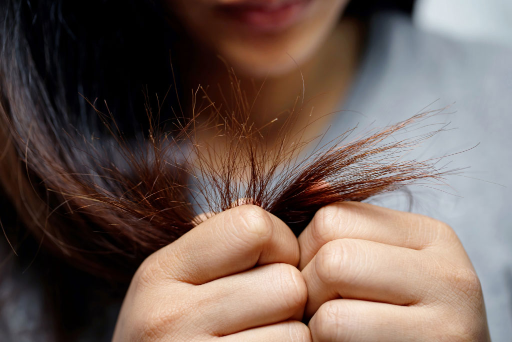 Winter Hair Loss: Tips to Combat Shedding in Cold Weather