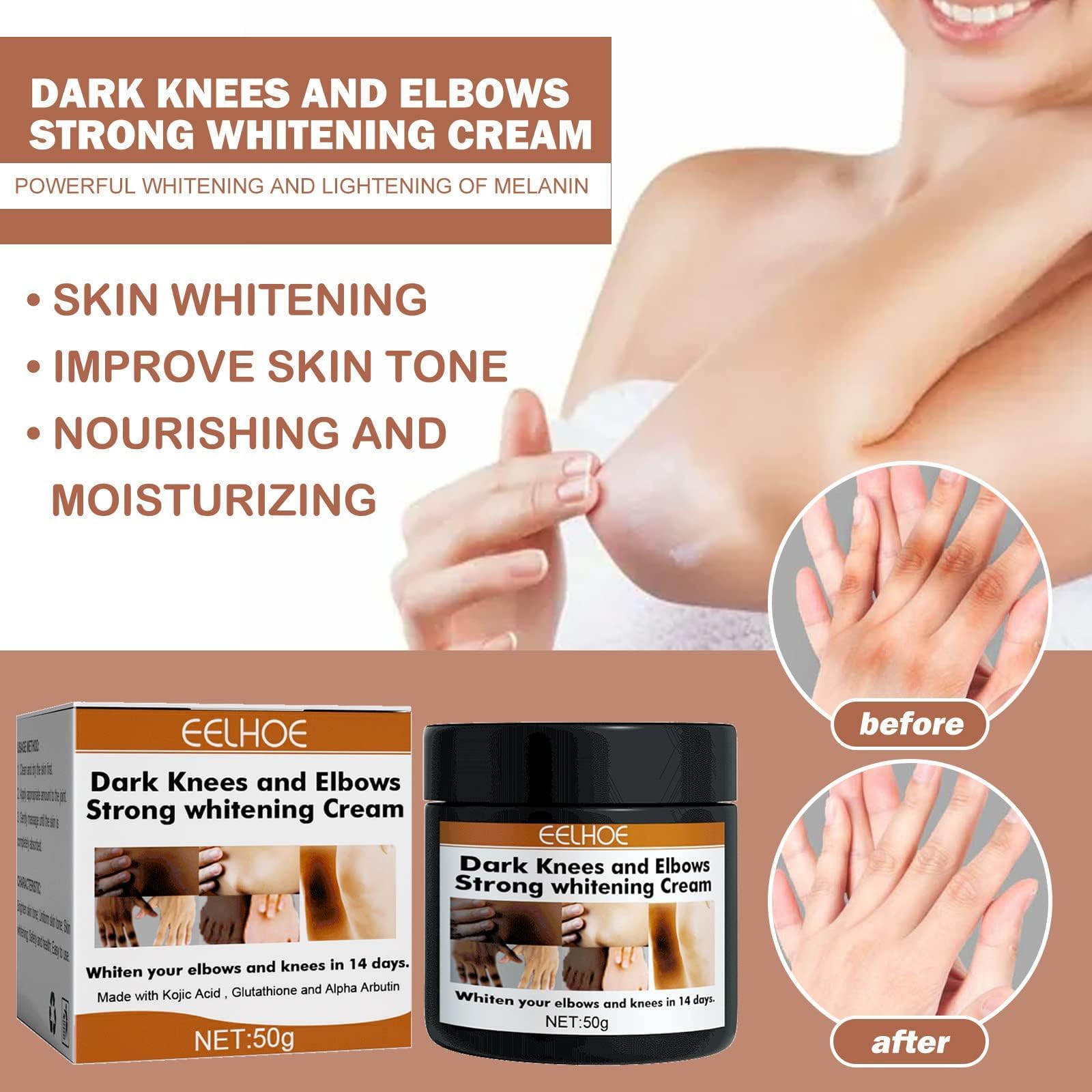 Top-Rated Knee and Elbow Lightening Creams for Even Skin Tone