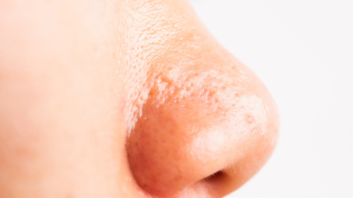 Got a Very Oily Nose? Heres How to Keep it Shine-Free.