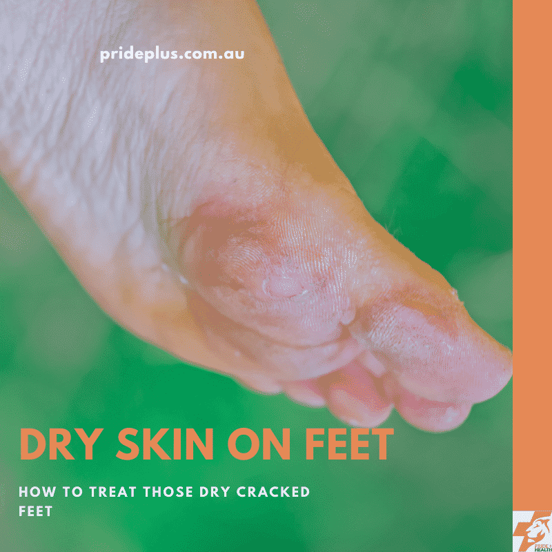 What oil for dry feet is best? (Easy tips for soft feet)