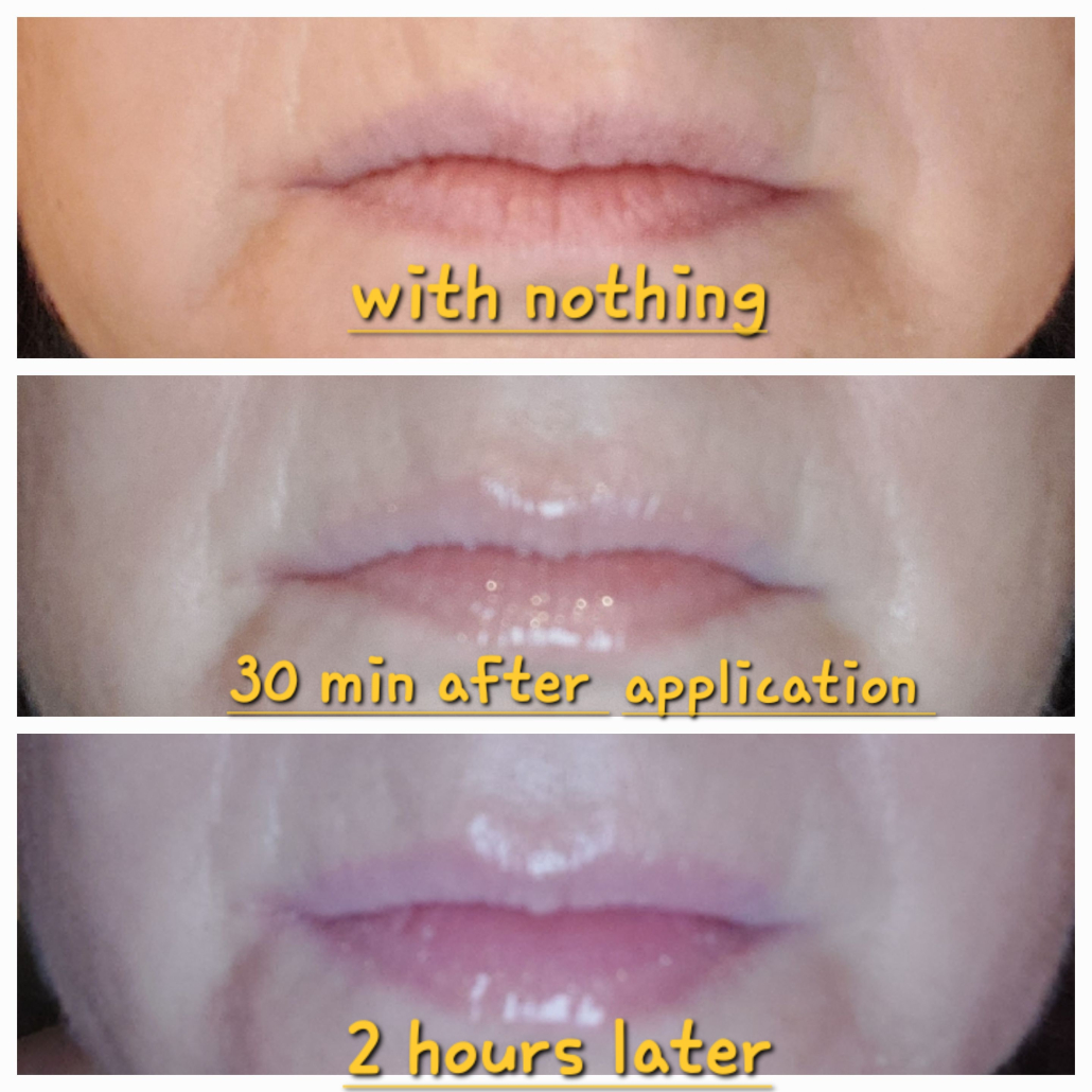 Are Lip Plumpers Safe? Is Lip Plumper Bad for You?