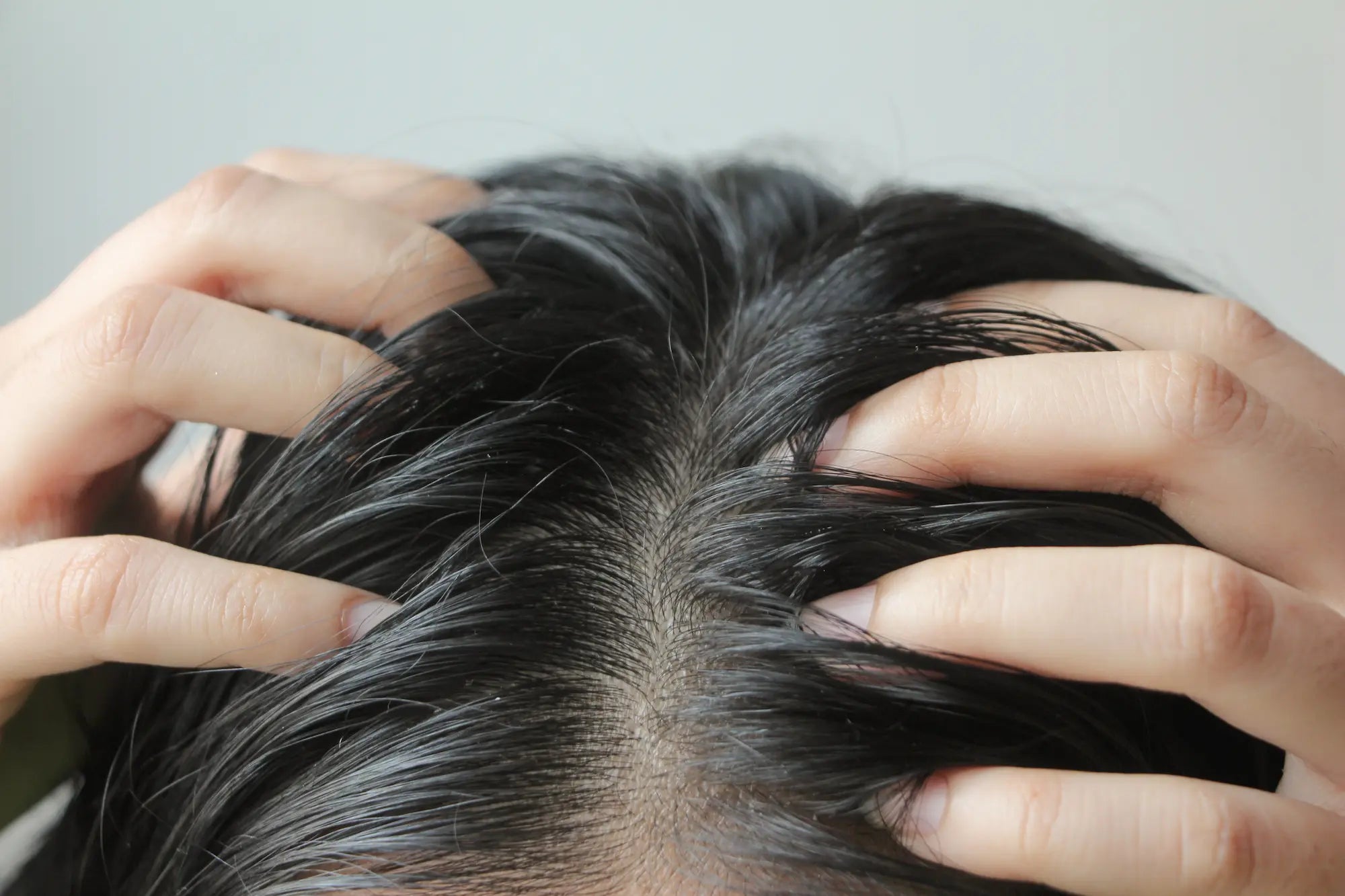 Stop! Does Hair Dryer Cause Dandruff or Make It Worse?