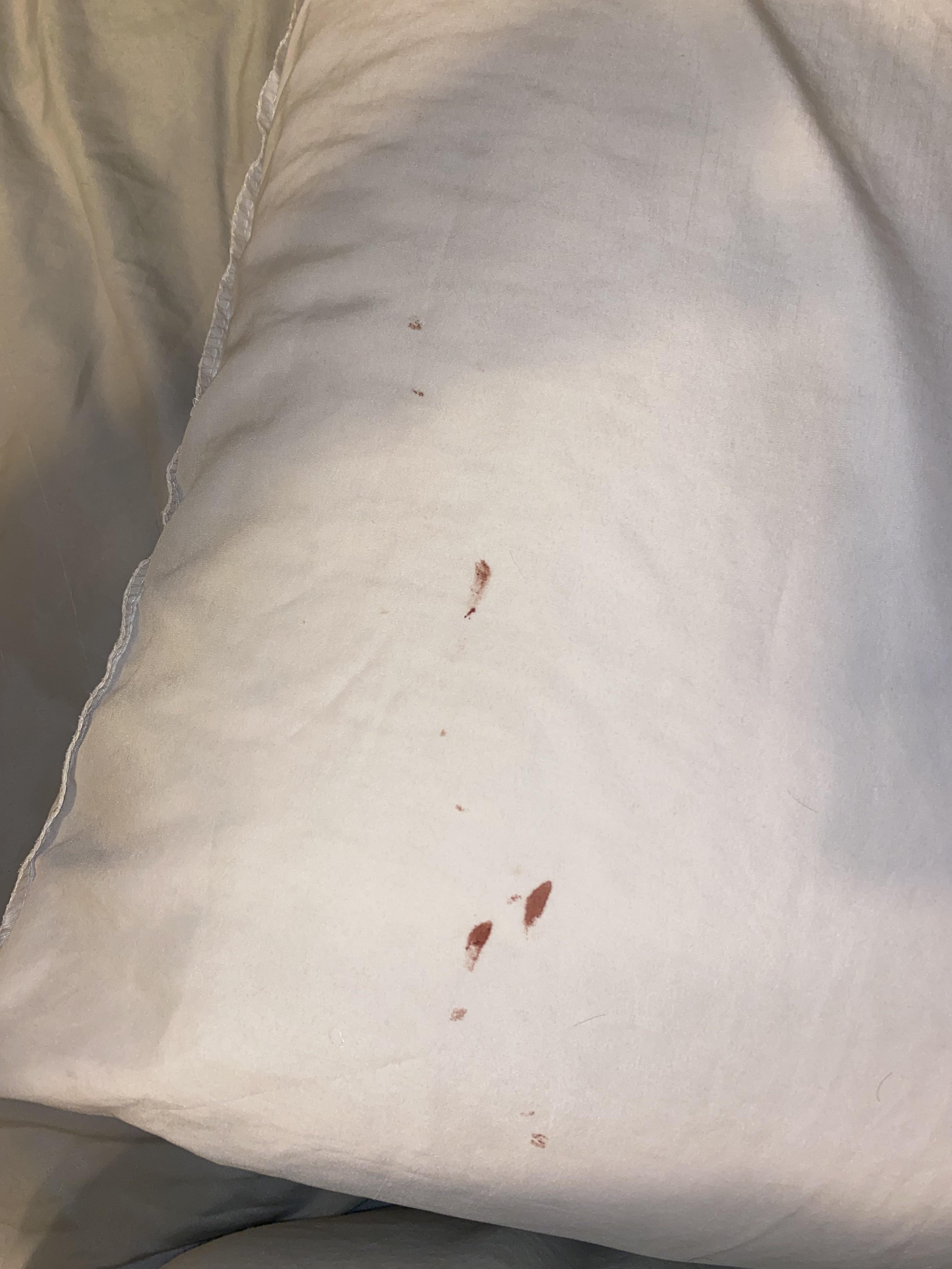 Finding Blood on Pillow After Waking Up:  Easy Fixes and When to See a Doctor