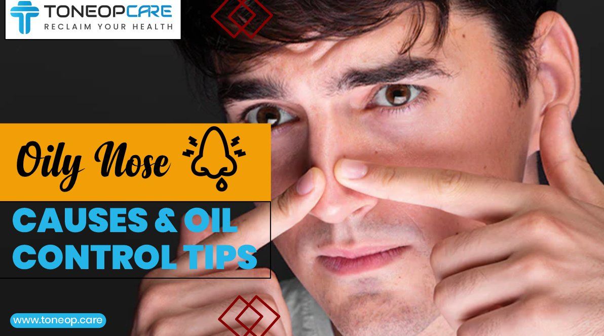 Dealing with a Very Oily Nose? Simple Tips for Shine Control.