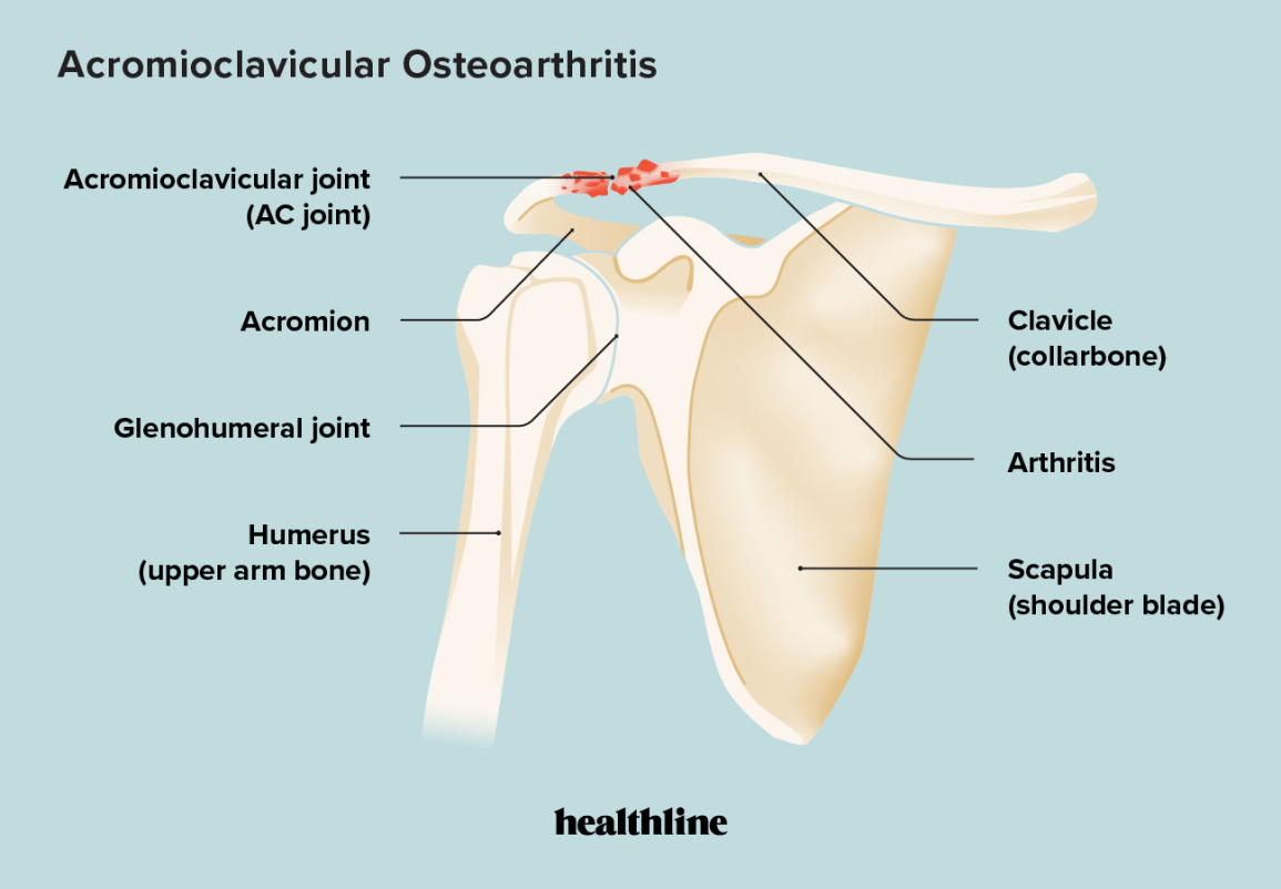 Does Your AC Cause Joint Pain? Understand the Connection Now