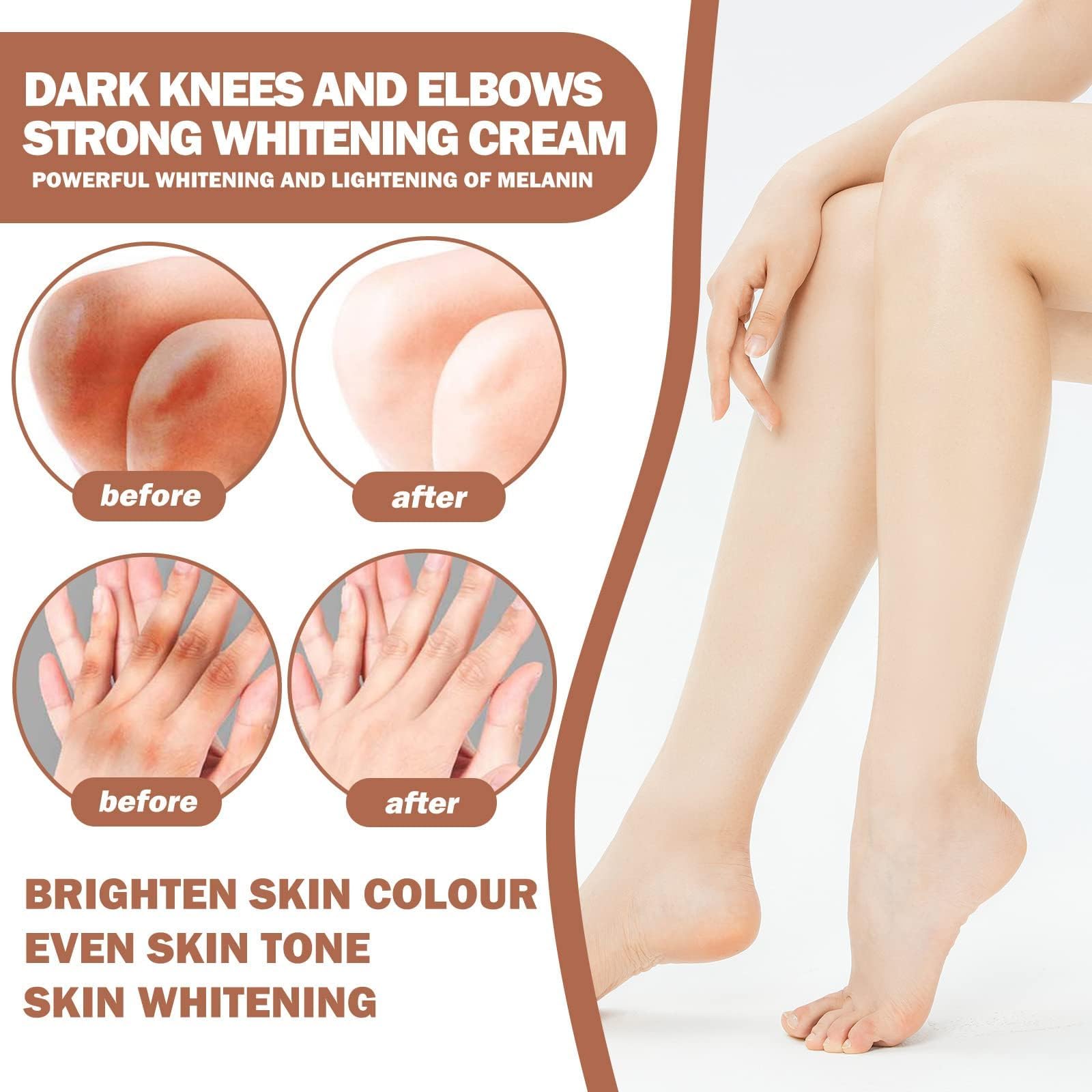 Top-Rated Knee and Elbow Lightening Creams for Even Skin Tone