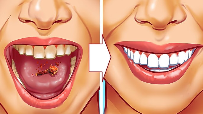 Get rid of orange plaque teeth: Simple steps for a healthy mouth