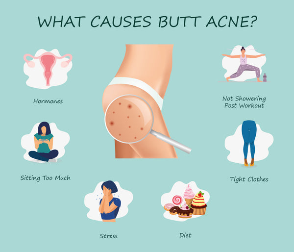 Putting Lotion in Your Butt: Benefits, Risks, and How-To Guide