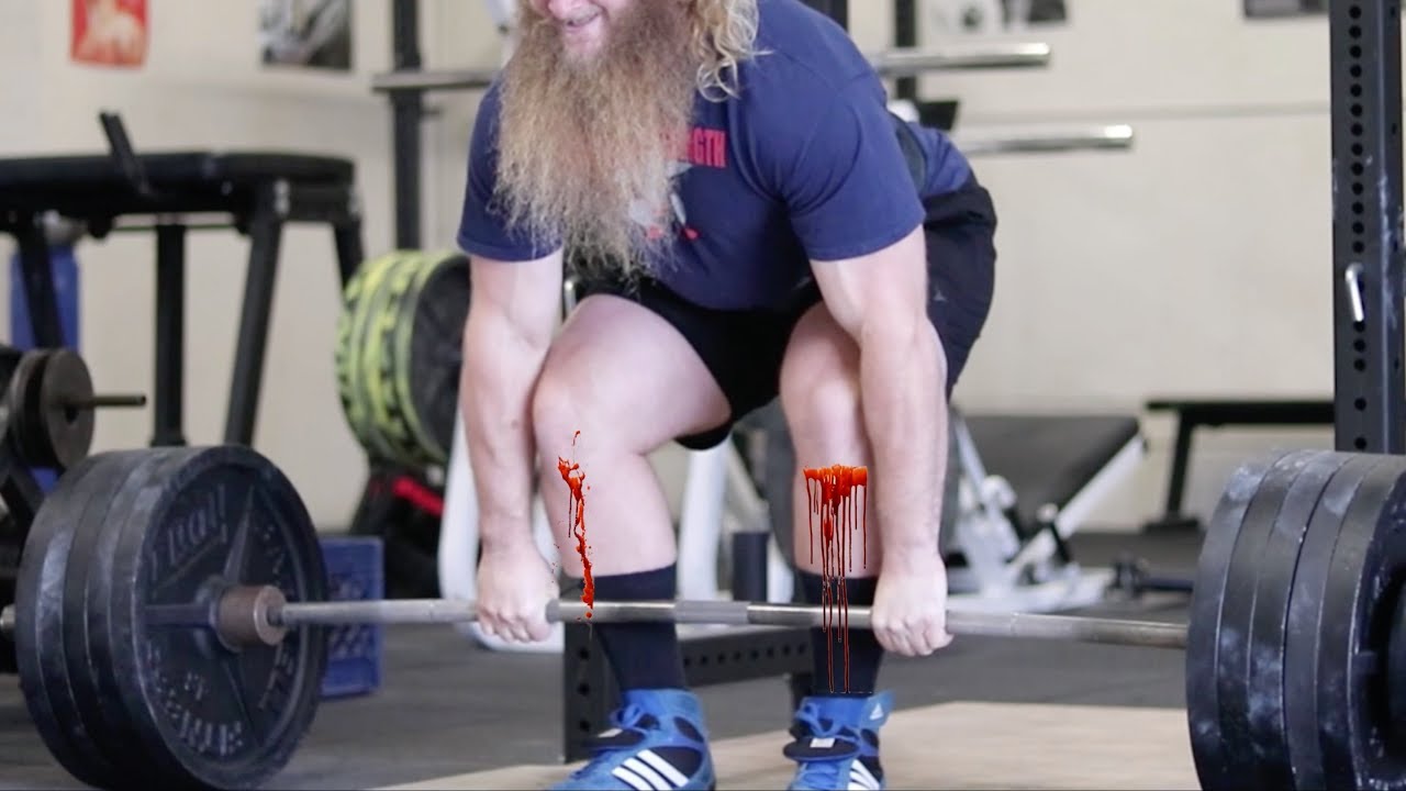 Deadlift Shins: Are your shins getting banged up from deadlifts?