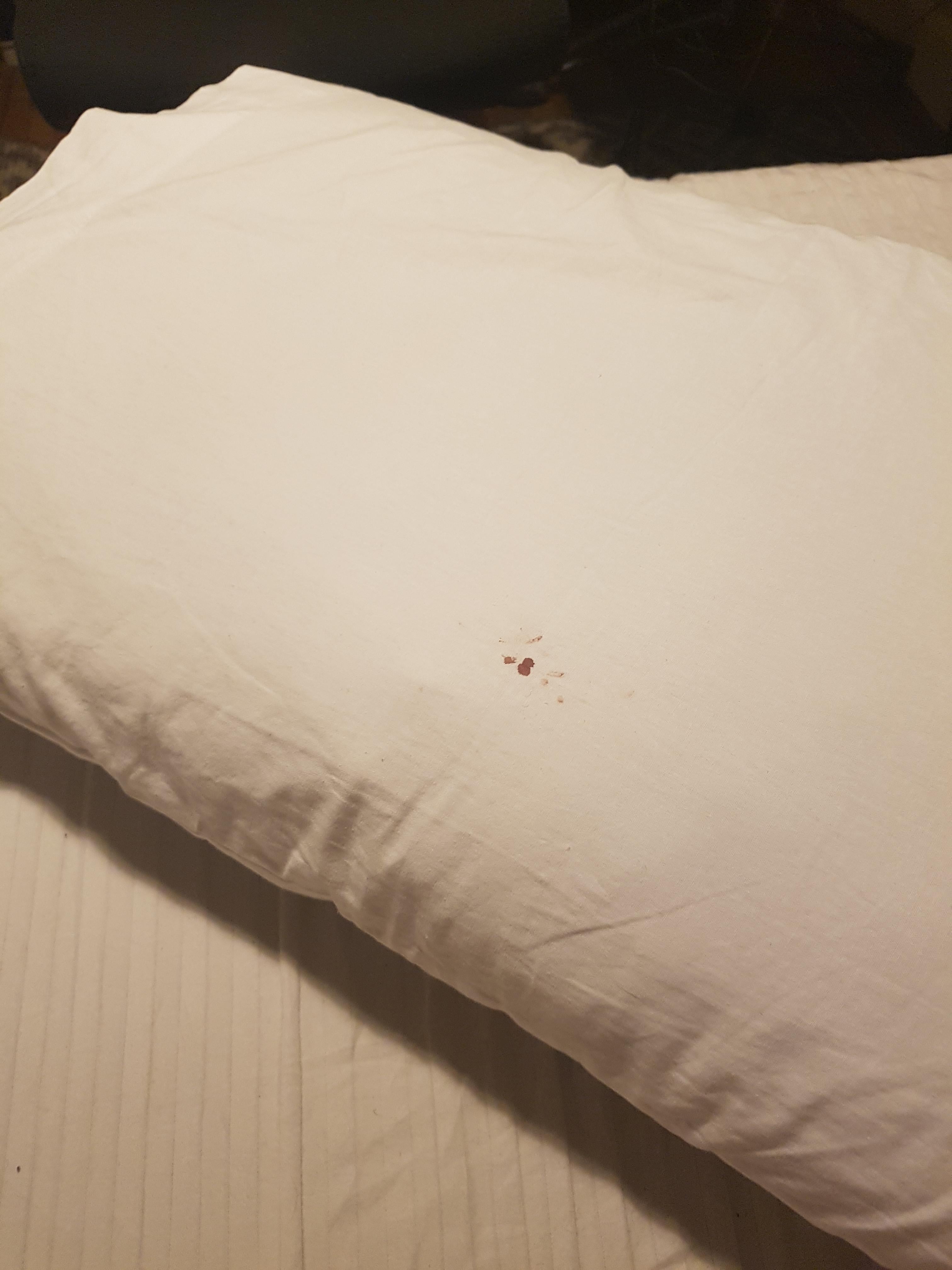 Finding Blood on Pillow After Waking Up:  Easy Fixes and When to See a Doctor