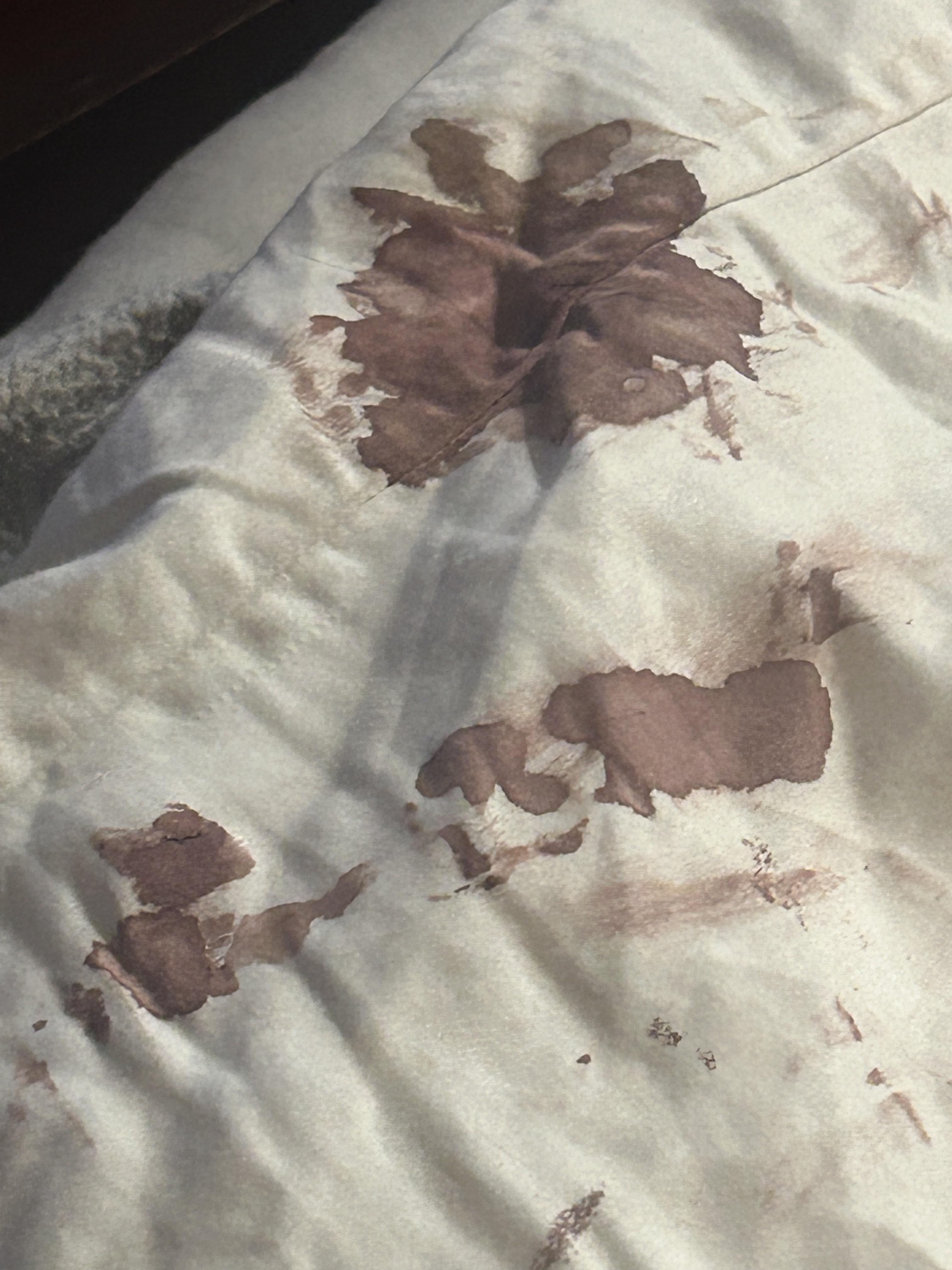 Finding Blood on Pillow After Waking Up:  Easy Fixes and When to See a Doctor