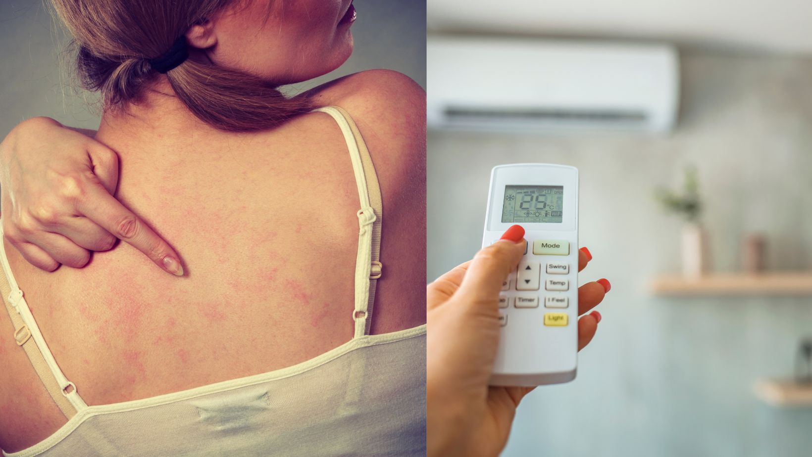 Bad AC Unit and Dermatitis: Exploring the Connection to Skin Issues