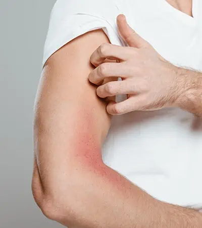 Rash After Massage: Is It Normal? Get Answers Here.