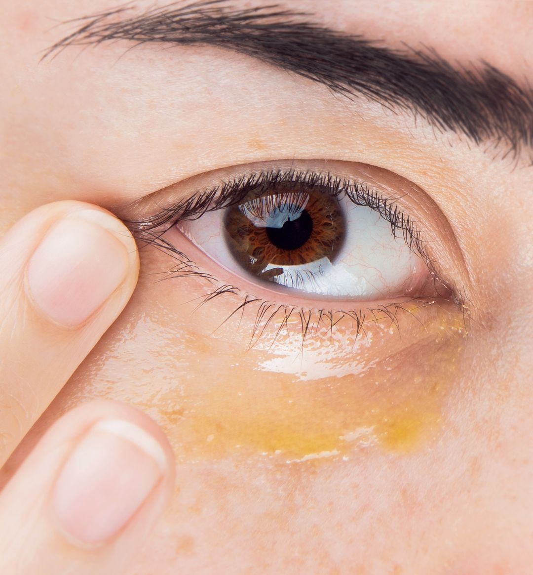 How to Exfoliate Under Eyes: The Best Way to Avoid Irritation