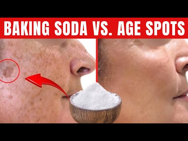 Castor Oil and Baking Soda for Dark Spots: Does It Really Work? Find Out Here!