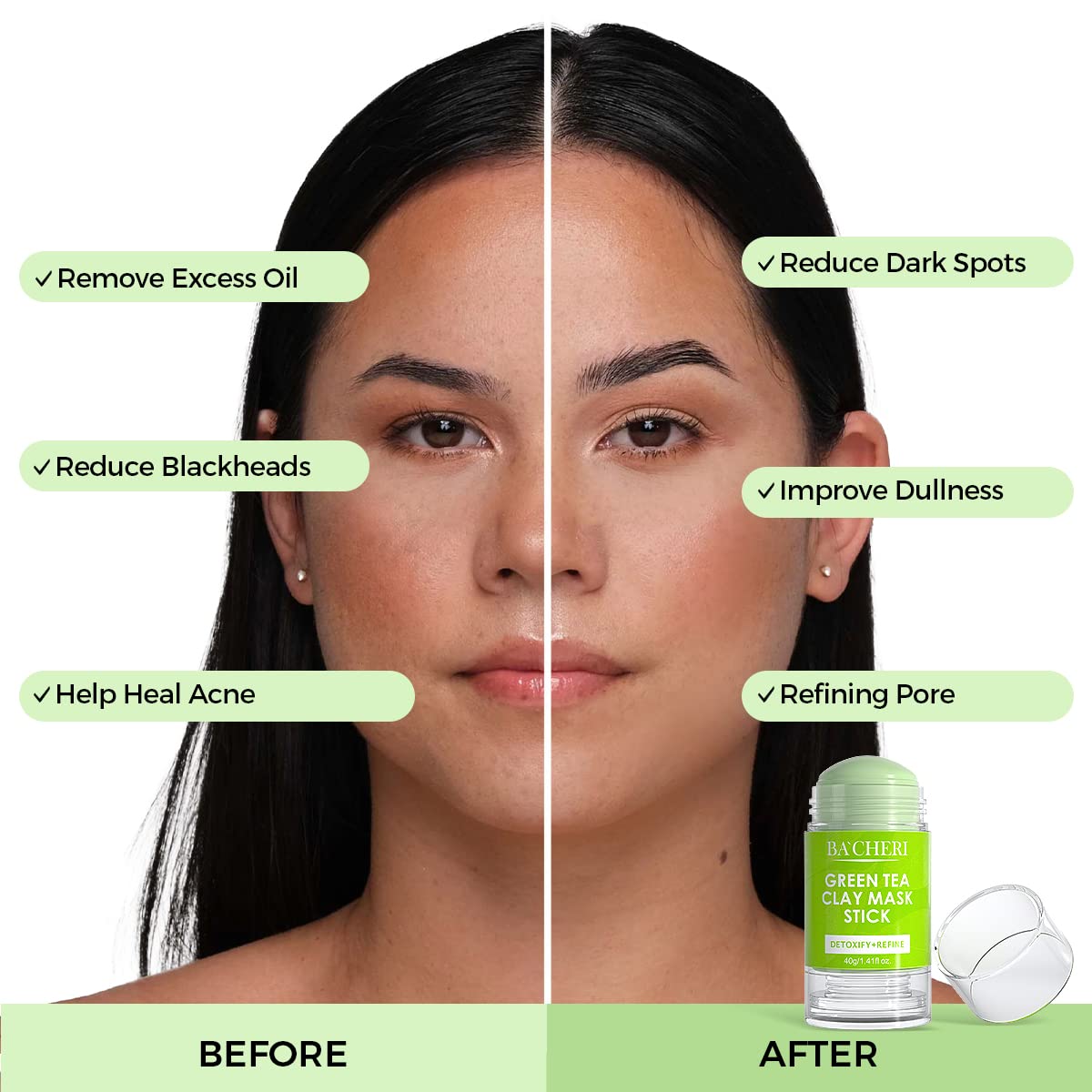 Matcha for Acne: Can It Help? Easy Guide for Better Skin Health.