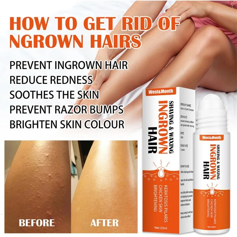 Say Goodbye to Ingrown Hairs with Dry Brushing Ingrown Hair: Your Ultimate Solution