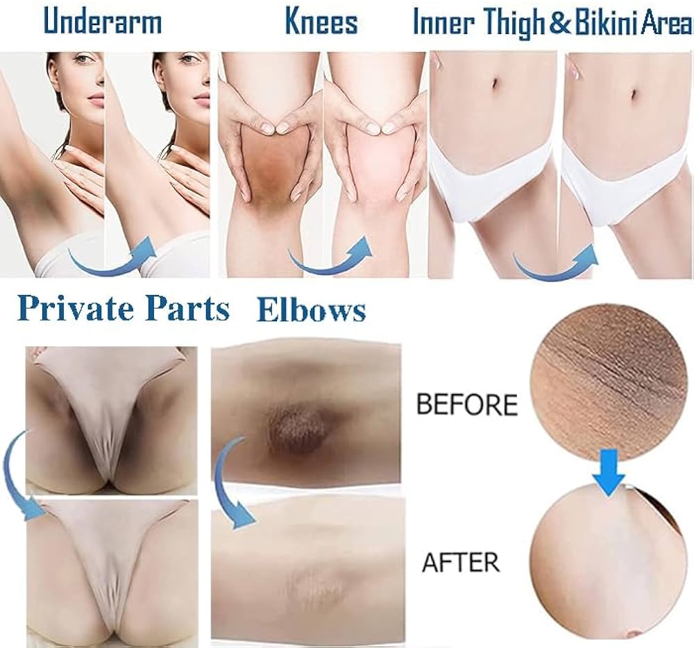 Genital bleaching cream reviews: Find out the best options for private areas.