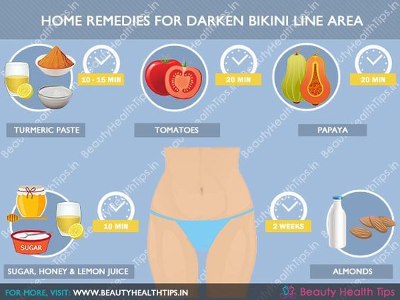 How to lighten bikini line naturally? Try these home remedies!