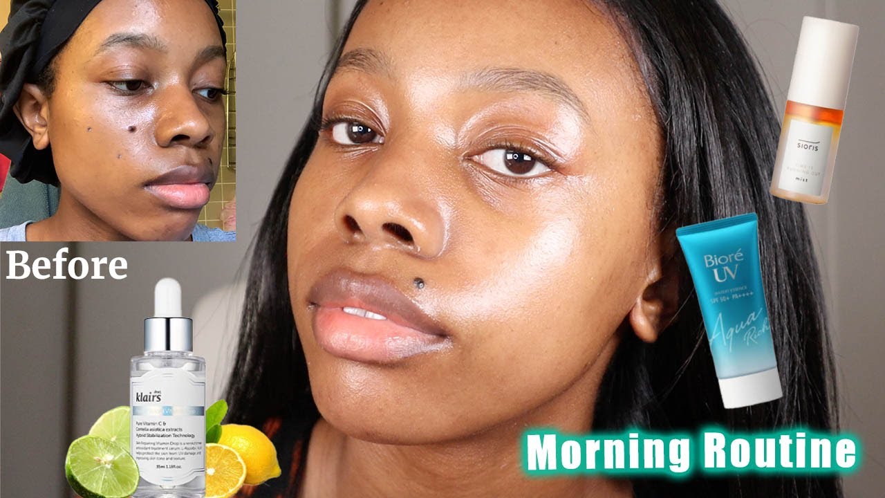 How to Use Korean Skincare for Acne Scars and Hyperpigmentation -  Get Rid of Dark Spots