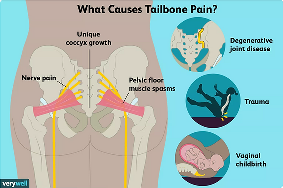 How to Manage Tail Bone Pain After Birth Effectively!