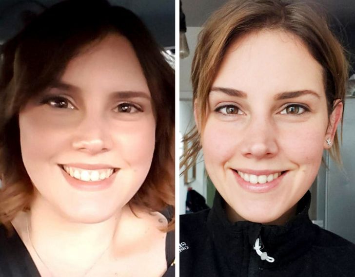 See the Difference: Fat Loss in Face Before and After Changes