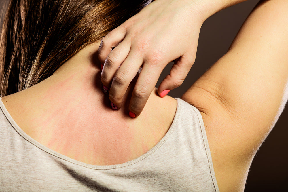 Rash After Massage: Is It Normal? Get Answers Here.