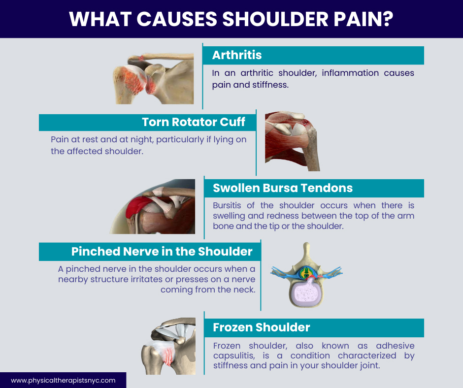 What Causes Ouse Shoulder? Learn How to Identify and Manage Ouse Shoulder for Quick Recovery