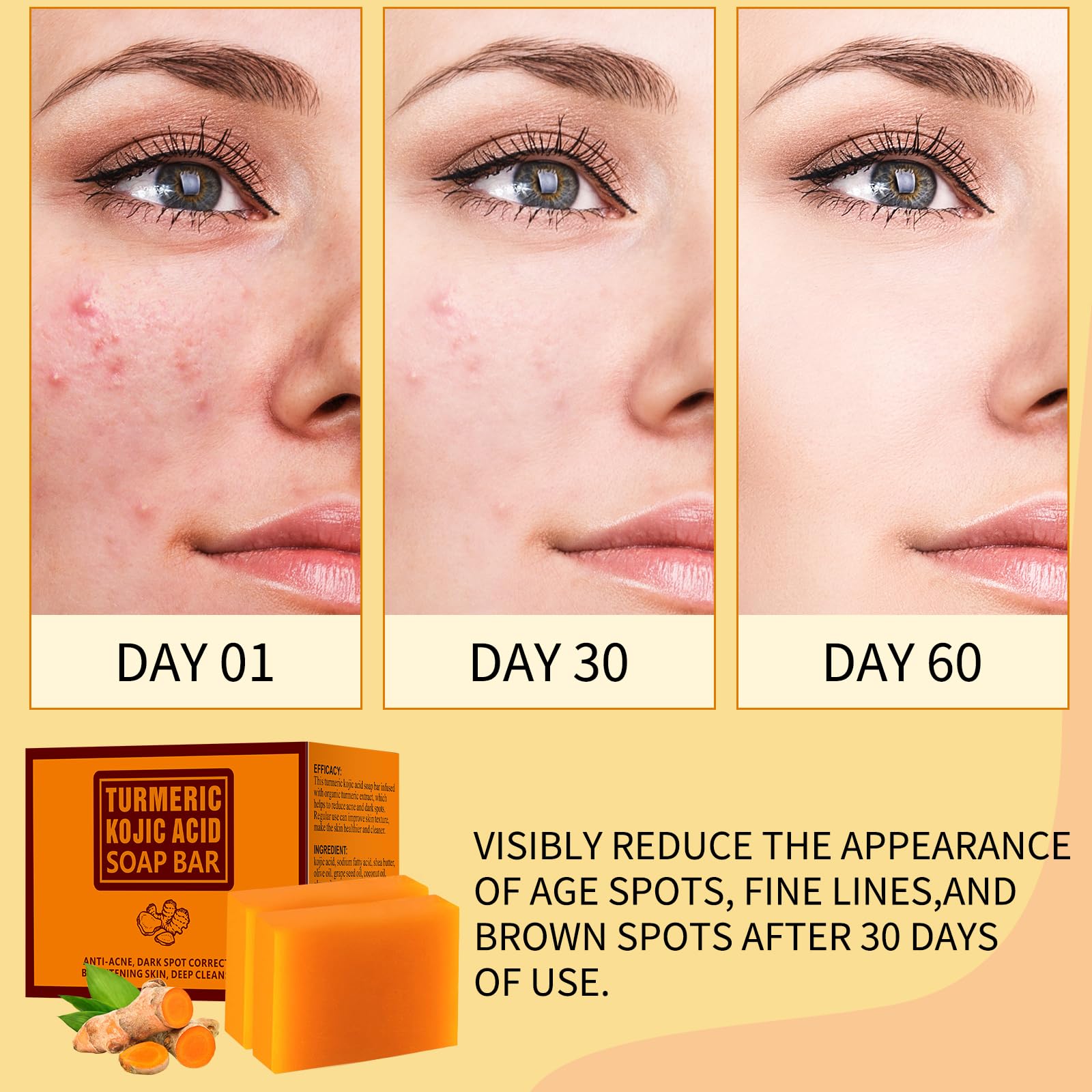 Use Turmeric and Kojic Acid Soap Benefits For Brighter Skin?