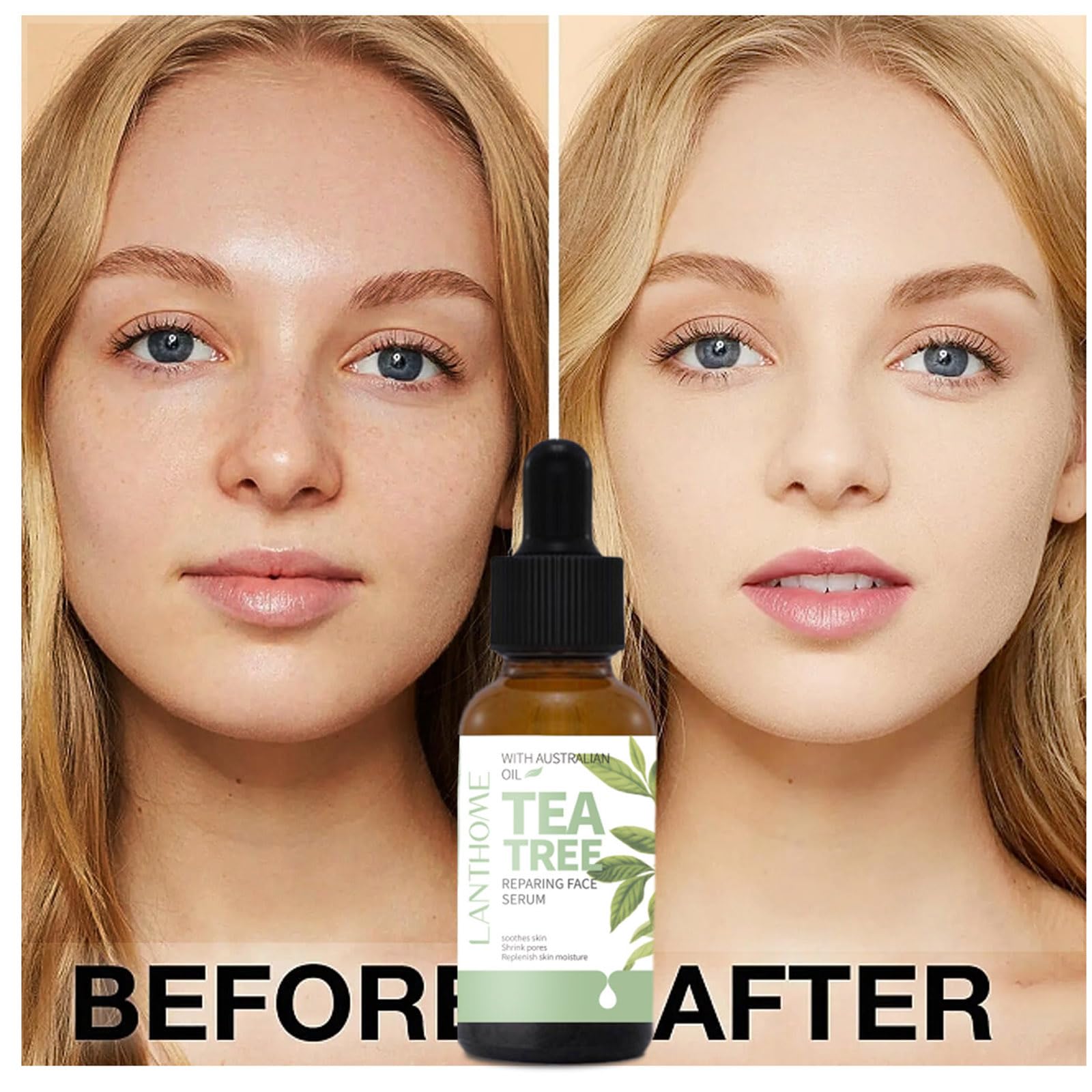 Can Tea Tree Oil for Hyperpigmentation Help? Find Out Here!