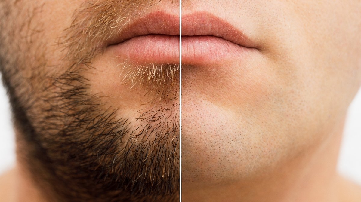 Daily Shaving: Good Or Bad? Is It Bad To Shave Your Face Everyday?