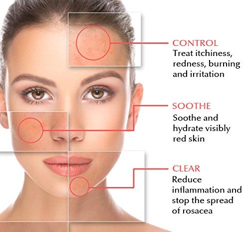 Using Face Oil for Rosacea: Tips for Happy Skin.