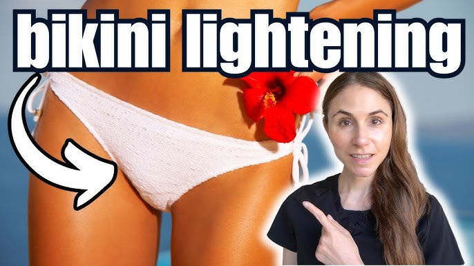 How to Get Rid of Dark Marks on Bikini Line (Easy Home Remedies)